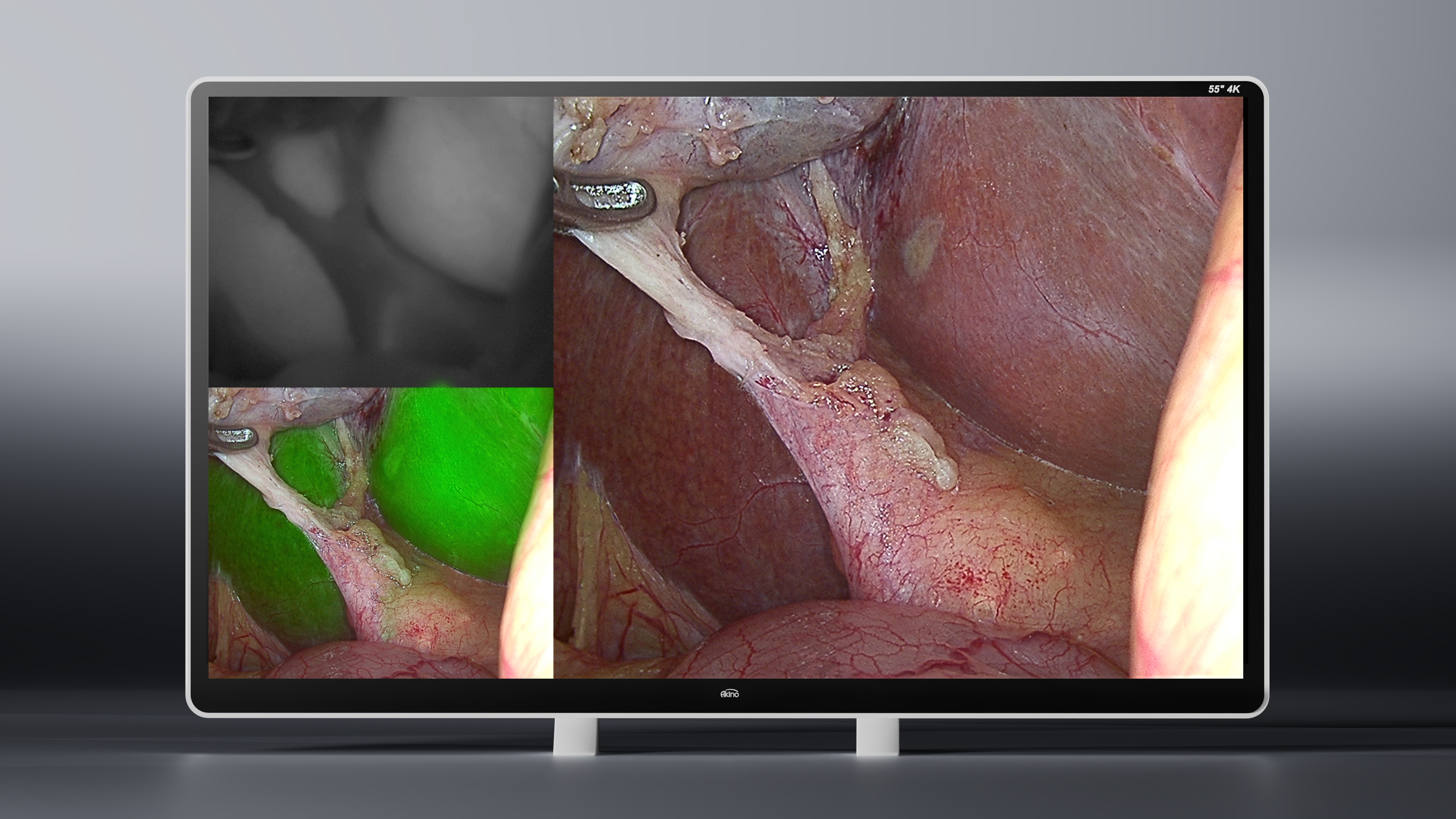 55” 4K Surgical Displays